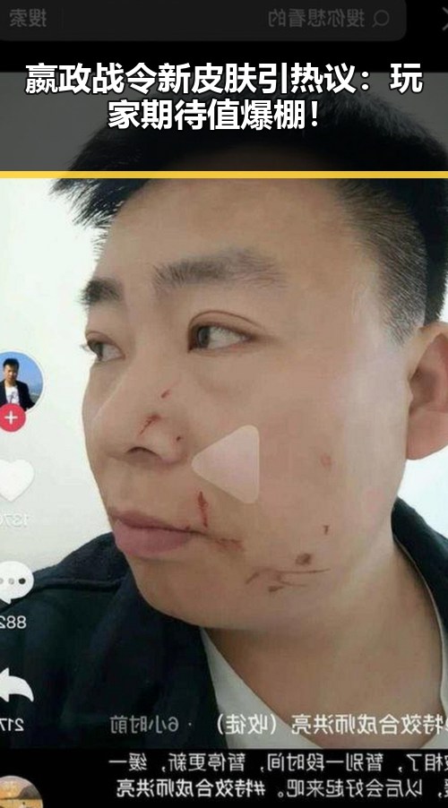嬴政战令新皮肤引热议：玩家期待值爆棚！